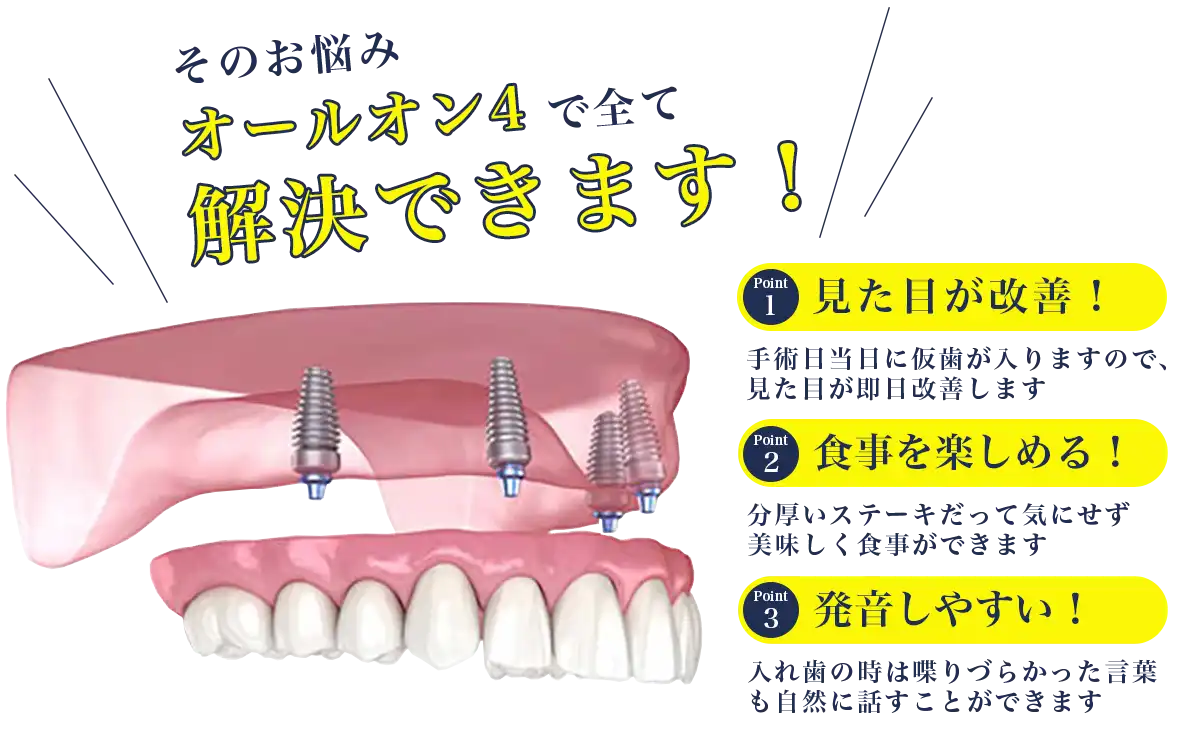 オールオン4で問題を解決いたします！
