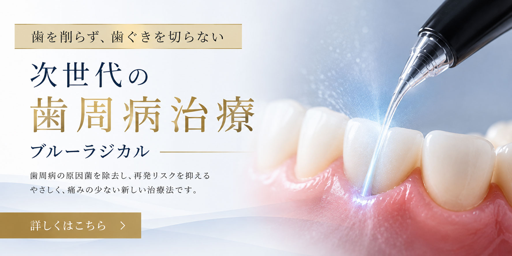 歯茎を切らない次世代の歯周病治療 ブルーラジカル 詳しくはこちら