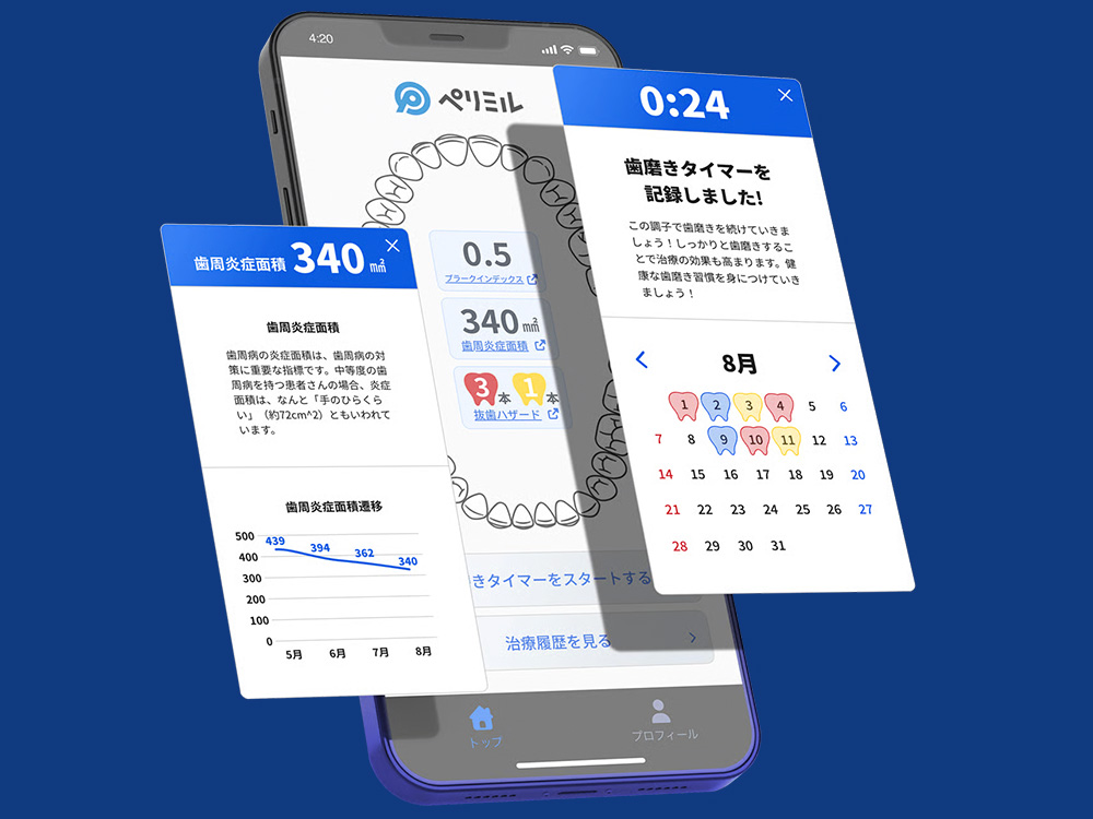 治療・メンテナンス