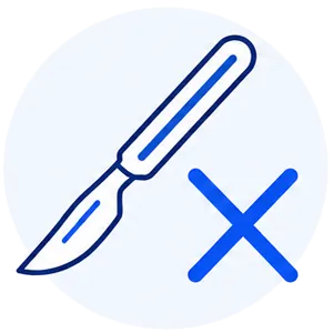 切開・縫合を伴わない治療のイラスト