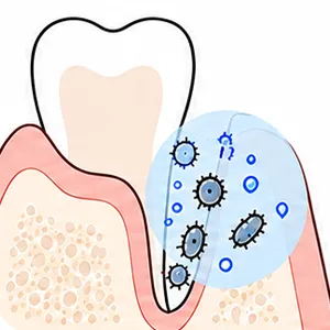 ラジカルが細菌に作用する図解